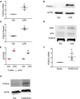 FOXC2 Autoregulates Its Expression in the Pulmonary Endothelium After Endotoxin Stimulation in a Histone Acetylation-Dependent Manner